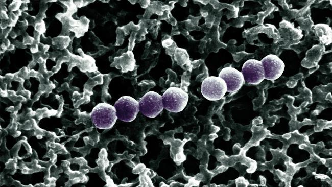 Pneumococcus or Streptococcus Pneumoniae is a common host found in the mucosa of the mouth and pharynx.