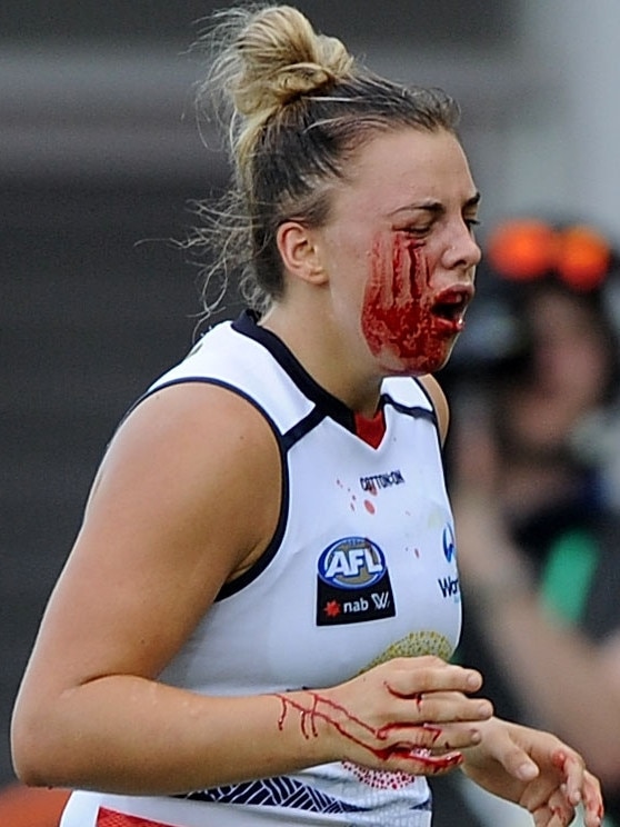 Marinoff runs from the ground after a head knock in the 2018 season. Picture: AFL Media