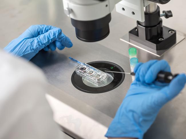 Technician in blue gloves does control check of the in vitro fertilization process using a microscope. Closeup. Horizontal.  Picture: Istock