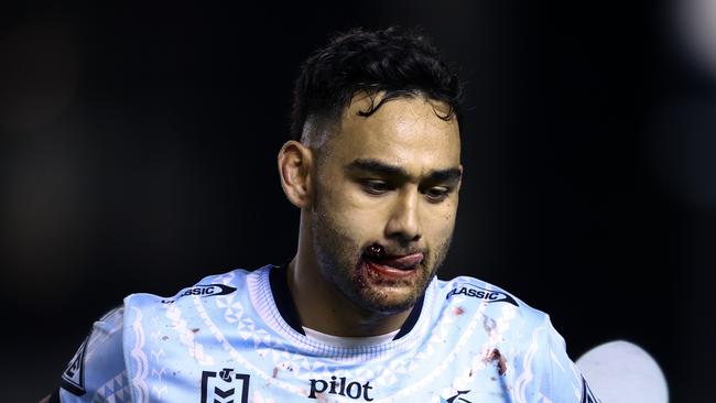 Briton Nikora’s lip was split open following the brutal head clash. (Photo by Jason McCawley/Getty Images)