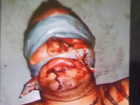 Shocking ‘torture’ image of kidnapped bikie