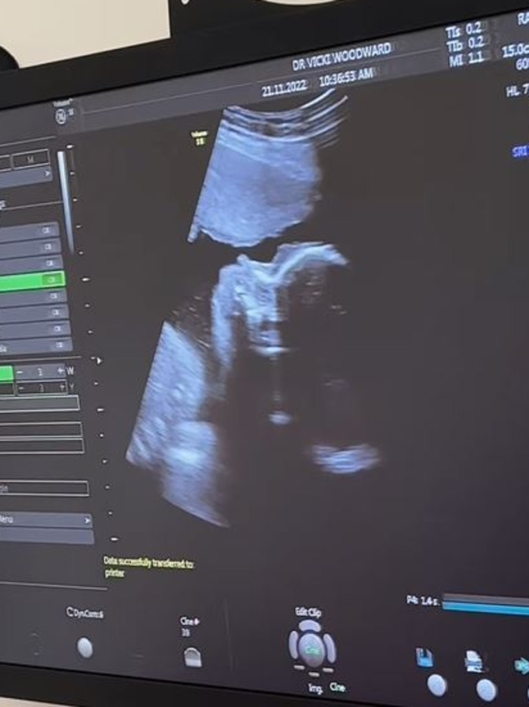 The couple shared a photo of the sonogram. Picture: Instagram/Martha Kalifatidis