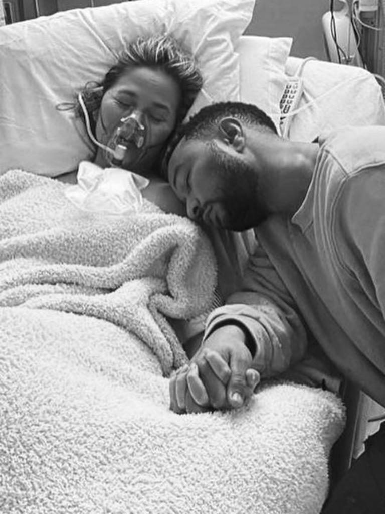 Chrissy Teigen Shares Instagram Post A Year After Miscarriage Herald Sun 