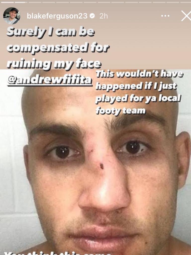 Blake Ferguson is seeking insurance cover to fix his nose.