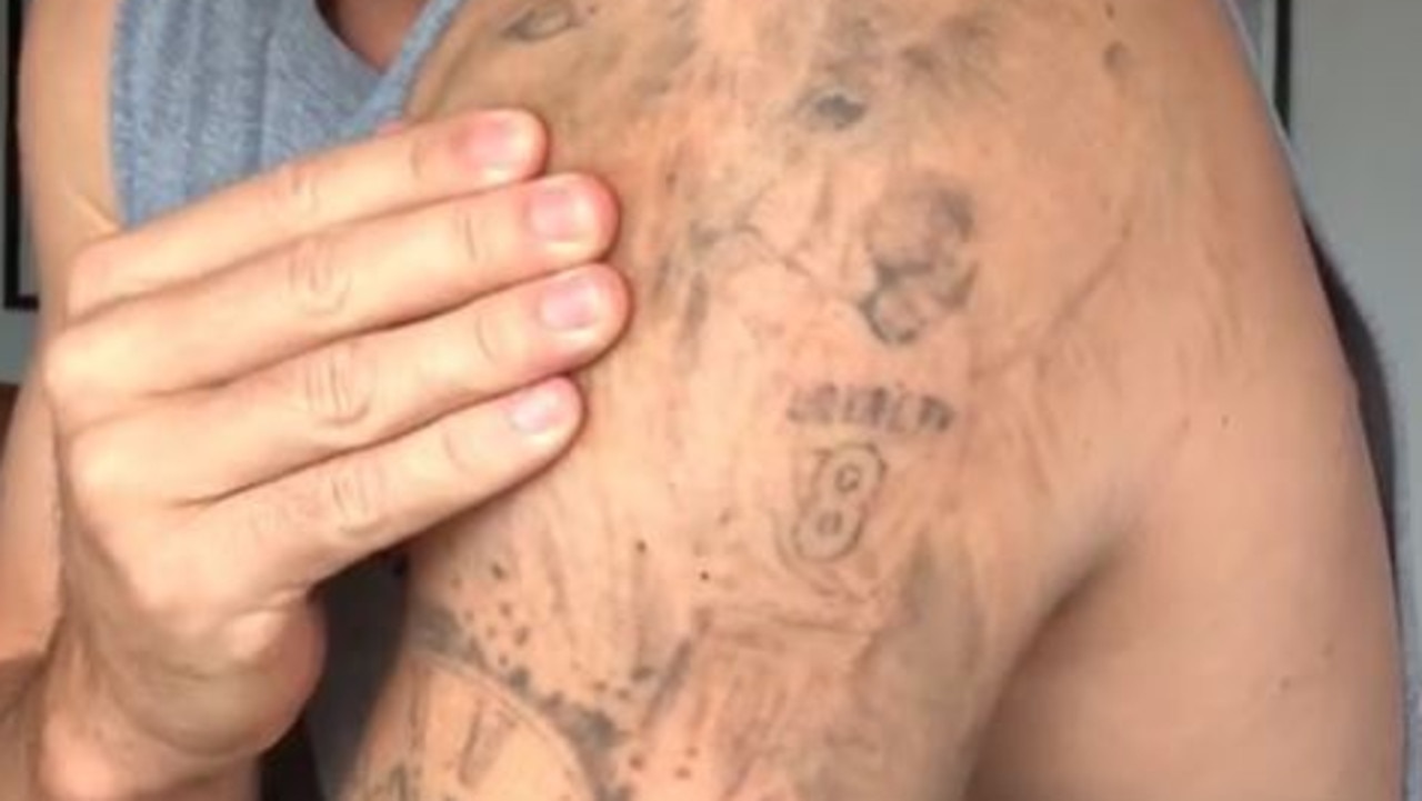 Australijski aktor Samuel Davies usuwa tatuaż o wartości 10 000 dolarów dla Netflix