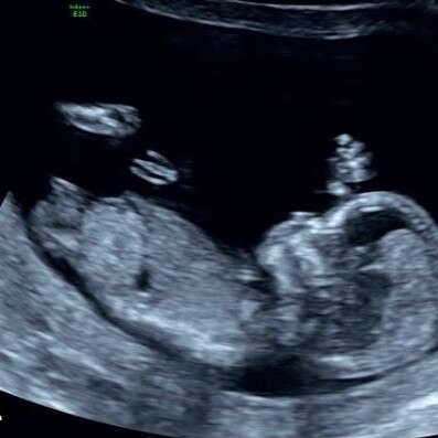 The ultrasound photo of baby Khawajy. Picture: Instagram