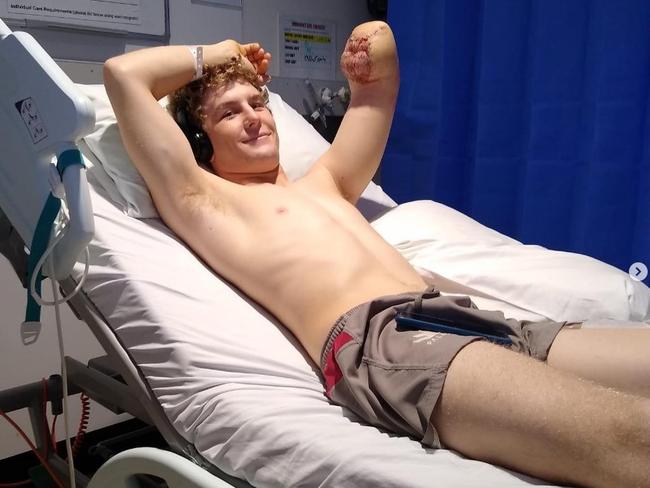 British backpacker Henry Dunn lost his lower left arm after a workplace accident on a remote Northern Territory cattle station.