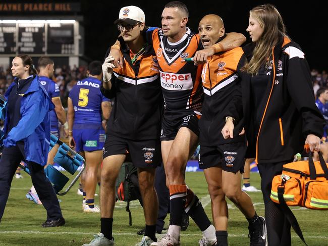 Brent Naden of the Wests Tigers is assisted off the field. Picture: Mark Metcalfe/Getty Images