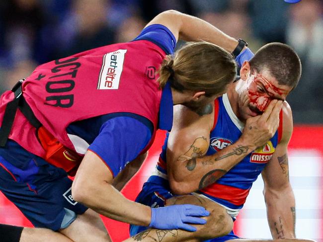 Tom Liberatore is treated after his face was cut and he was concussed. (Photo by Dylan Burns/AFL Photos via Getty Images)