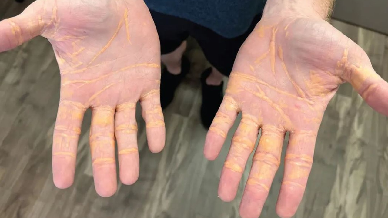 Grim hands of man who ate only meat, cheese