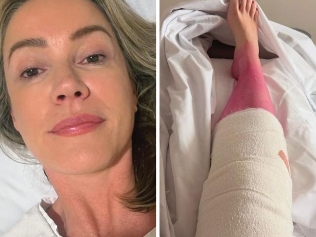 Leila McKinnon shared "alarming" pictures from her hospital bed. Picture: Instagram