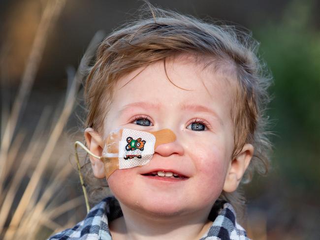 16 month old, Ryder Barton has been diagnosed with severe gastric reflux and oral aversion disorder. He is unable to eat, and is instead feed through a nasal-gastric tube. He will need surgery to fix the issue, which causes him pain and results in regular vomiting, including most nights. The surgery could change is life but isn't deemed emergency so will likely be waiting months. His parents are desperate for help.  Picture: Sarah Matray