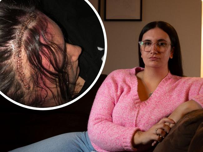 After years monitoring what doctors believed to be a birthmark on her brain Amy Docherty was told she’d actually been living with cancer.