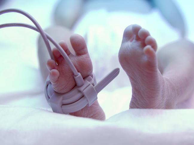 Feet of new born baby under ultraviolet lamp in the incubator. iStock Image - Generic