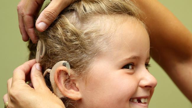 Being fitted with a cochlear implant. Picture: Alison Wynd