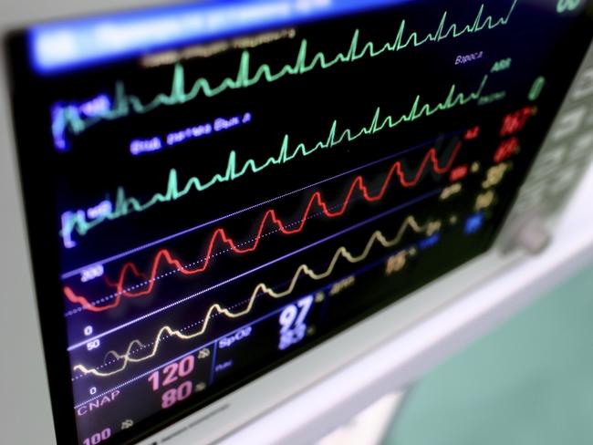 ORGANS  ..  generic photo of a heart rate monitor. Picture: iStock