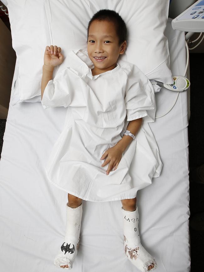 Successful surgery by Melbourne experts has repaired Chien Lu’s feet. Picture: David Caird