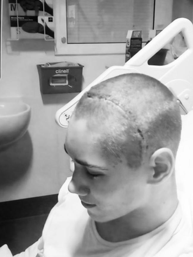 Shane Barker after his brain surgery in 2018 aged 17. Picture: Supplied