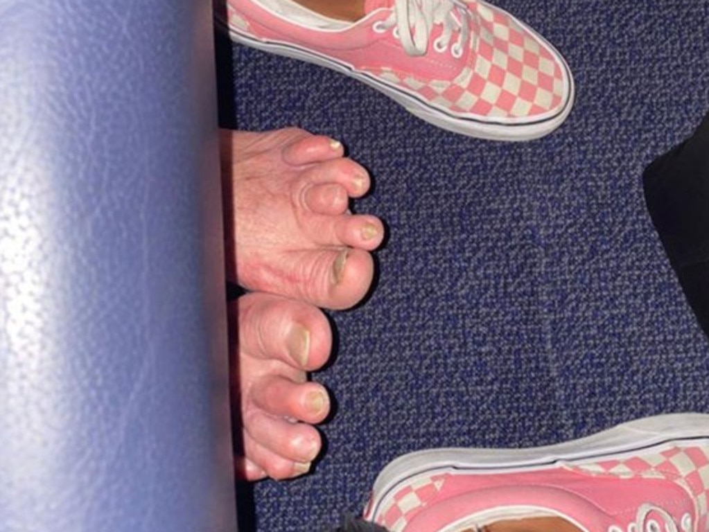 Social media users were left horrified by the state of their feet