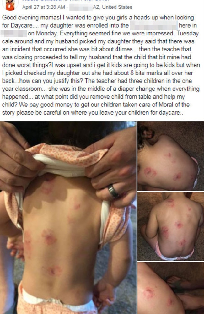 She shared the horrifying photos in a lengthy Facebook post. 