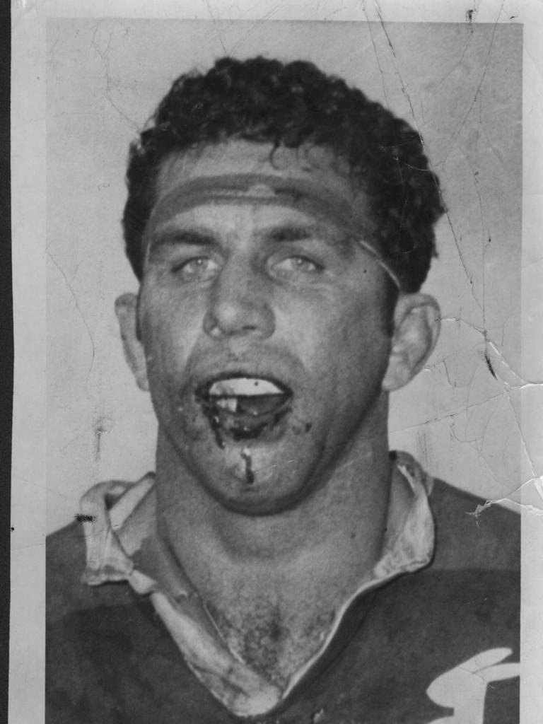 John Sattler famously played with a broken jaw in the Rabbitohs 1970 Grand Final victory of Manly. 16/07/72. pic News Limited. P/