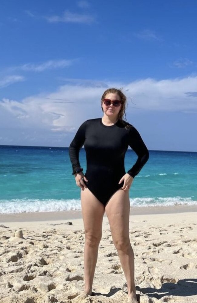 Amy Schumer has debuted her weight loss after having liposuction.