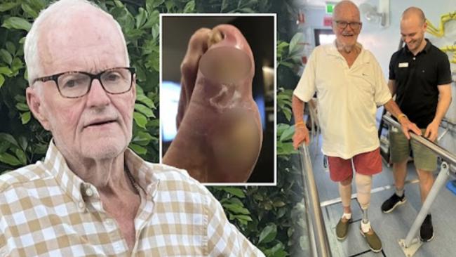 Barry Porter is the face behind a thriving Mackay hardware store. But not everyone knows his incredible story of survival, which started after he put on shoes too big while cleaning his driveway.