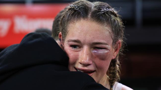 Tayla Harris has suffered a gruesome injury in her fight against Millicent Agboegbulen, going down in the Super welterweight bout. Picture: Getty Images.