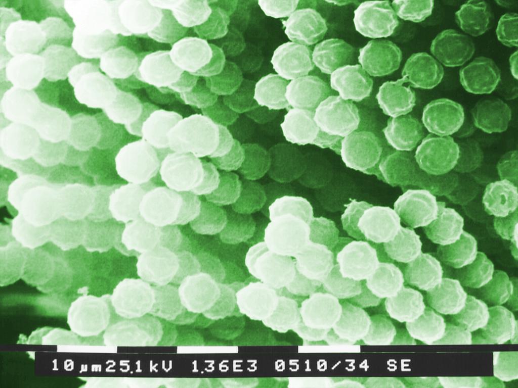 Aspergillus is also found in Australia. Picture: CDC/Janice Haney Carr