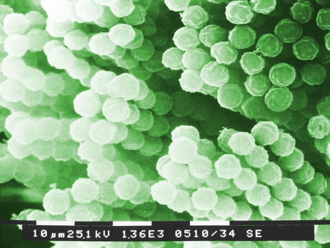 Aspergillus is also found in Australia. Picture: CDC/Janice Haney Carr