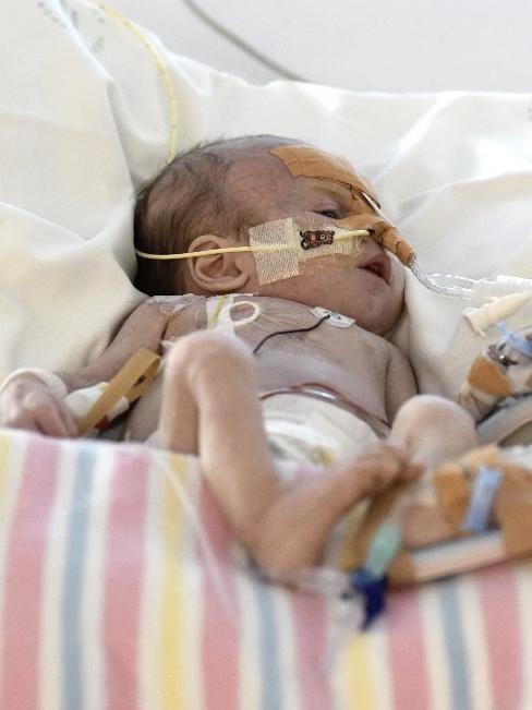 Cooper Low at Sydney Children’s Hospital in Randwick after he contracted myocarditis.