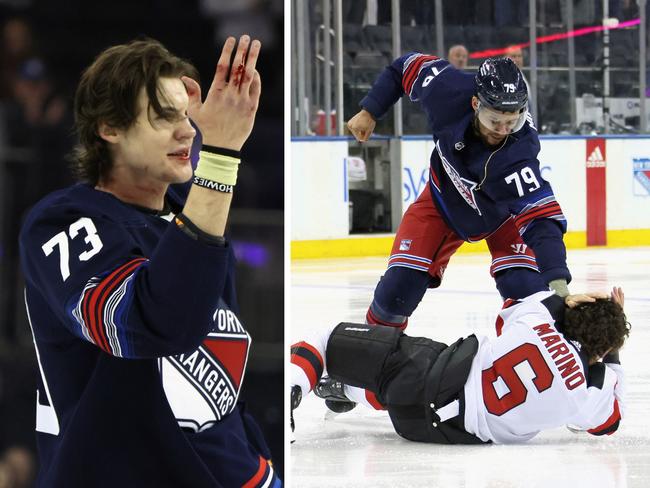 Matt Rempe's knuckles were bloodied. Photo: Getty Images