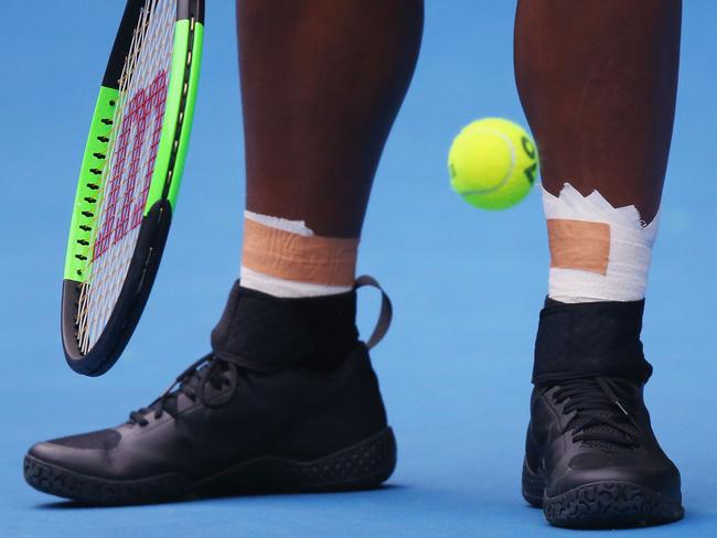 Serena Williams has been plagued by ankle injuries for several years. Picture: Michael Dodge/Getty Images
