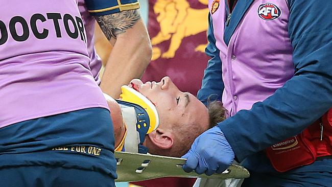 Medicos put Andrews in a neck brace after the clash. Picture: Getty Images