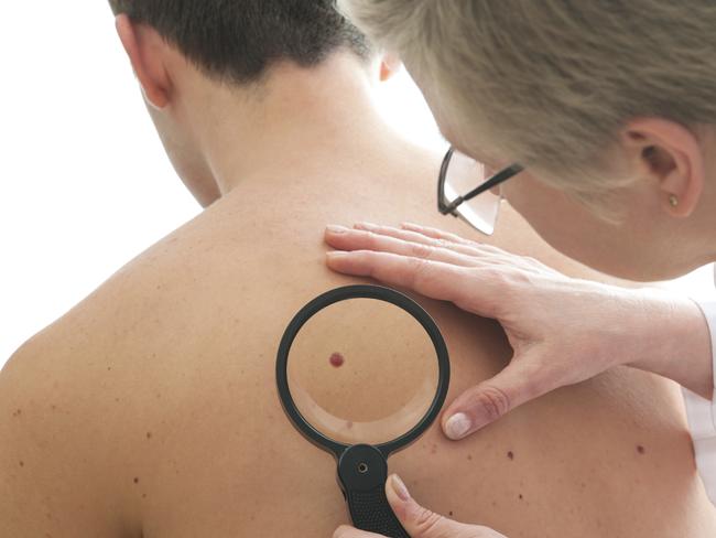 Dermatologist examines a mole of male patient