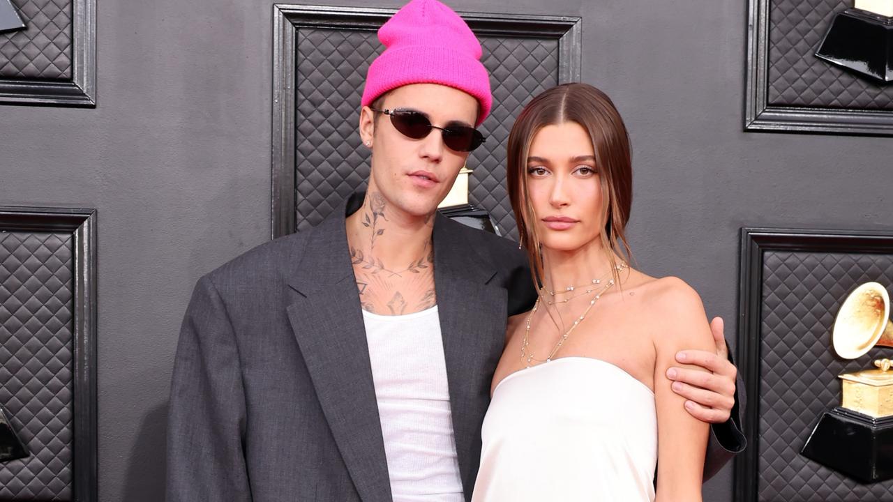 Justin Bieber has sparked major health concerns among fans with his changing appearance amid ongoing rumours about a rift in his marriage to wife, Hailey Bieber. Picture: Amy Sussman/Getty Images