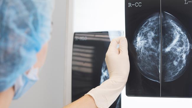 New Melbourne research has created sharper and more detailed images of mammograms that will improve breast cancer screening.