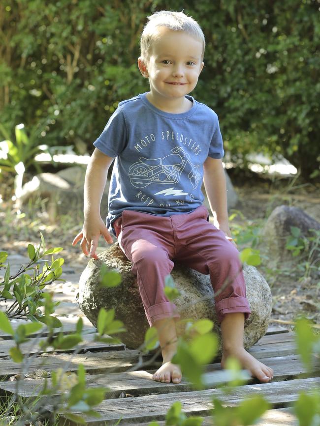 James Kirkegaard, 3, has had croup five times since last December, but thankfully, his twin sister Grace has missed out. Croup has been the number one reason for children presenting to the Queensland Children’s Hospital emergency department. Picture: Mark Cranitch.