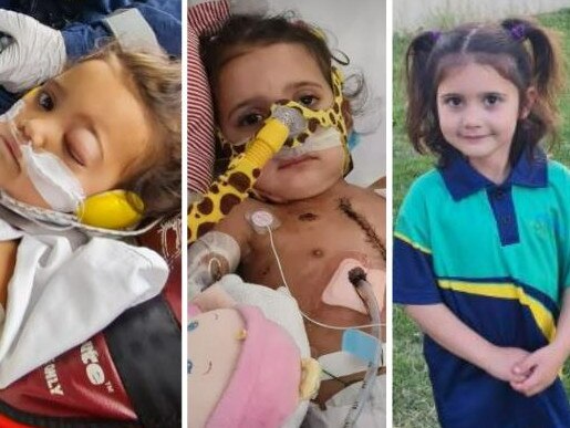 With her tiny body wracked with a collapsed lung, sepsis, double pneumonia and shock, two-year-old Charli Goodrich was too critically ill to airlift.