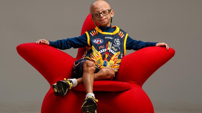 Enzo says he loves being different and “there is no other kid in Australia like me”. Picture: Matt Turner