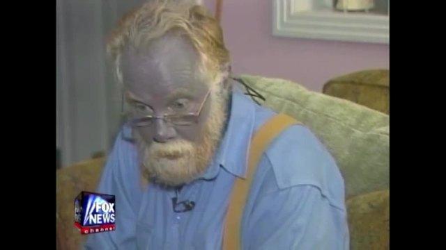 Real-life 'Blue Man' dies after heart attack, stroke