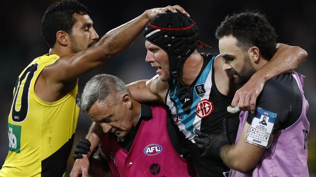 Concussion looms large on the radar of the AFL. Picture: Getty