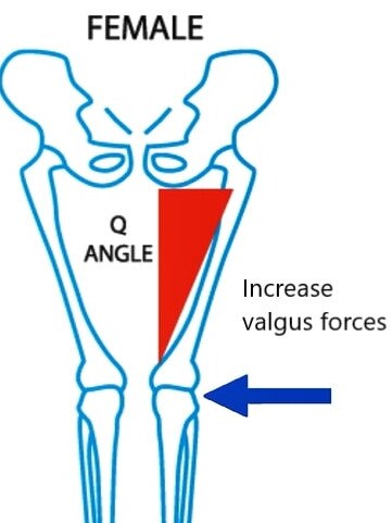 Diagram of the Q-angle difference between men and women.