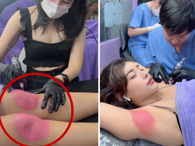 A bizarre new beauty trend is taking over as the strive for youth reaches new heights.