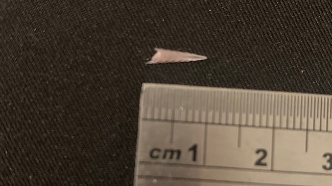 St Leonards woman Kate Portas required surgery after she stepped on a stingray. Pictured is the barb that was lodged in her toe. Picture: Supplied