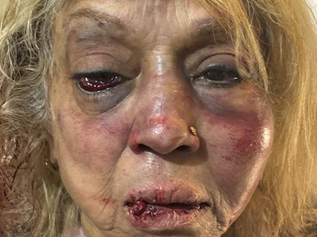 **Upsized and watermark removed**Ninette Simons, the victim of an assault and burglary in the Perth suburb of Girrawheen. Picture: WA Police