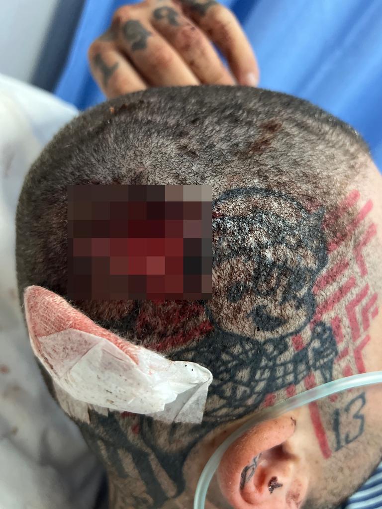 He suffered a head injury. Picture: GoFundMe