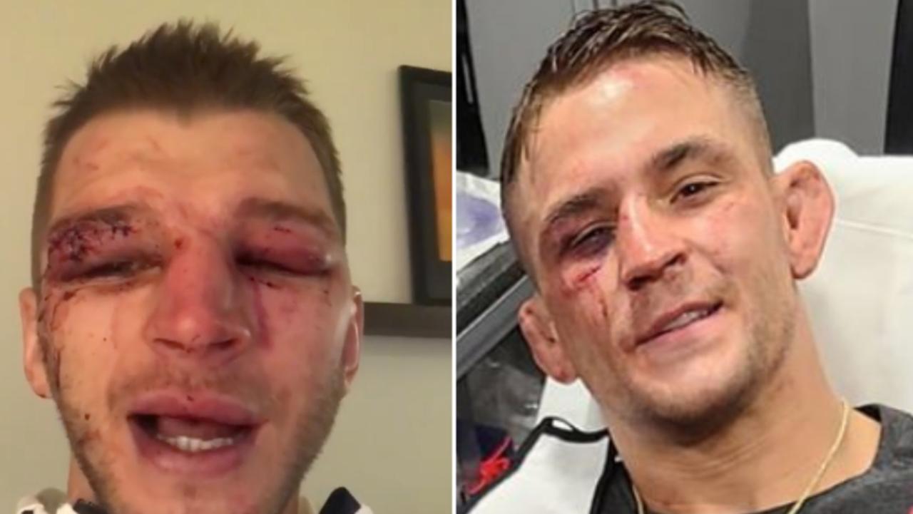 Dan Hooker and Dustin Poirier went to war.