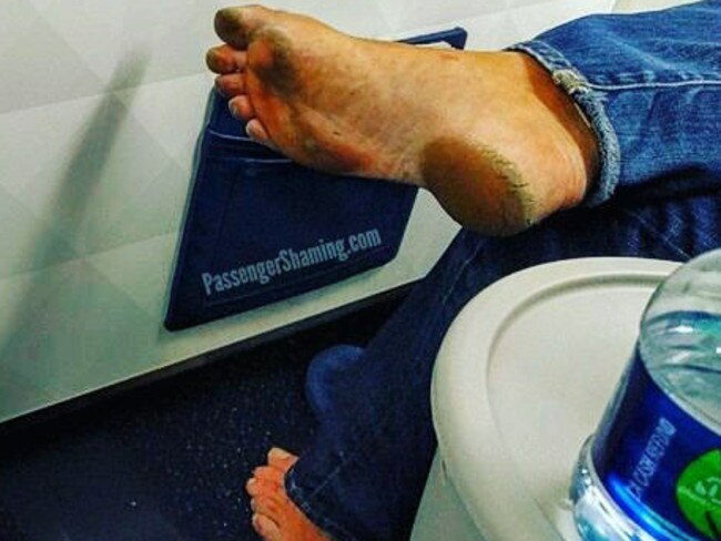 11. There had to be at least one guy with gnarly feet. Picture: Passenger Shaming