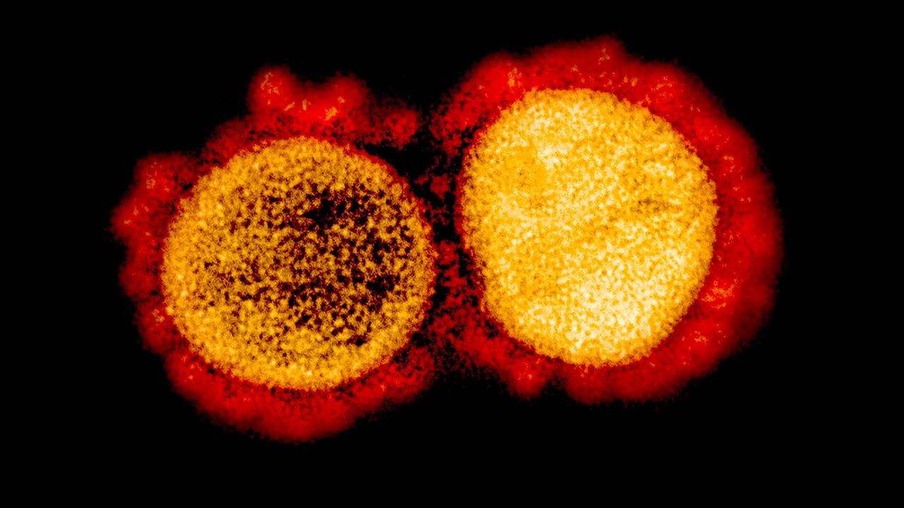 Covid cases are surging again in Australia. Picture: National Institute of Allergy and Infectious Diseases / AFP